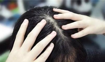 探索有效的头发修复方法（解决掉发问题的科学方法）