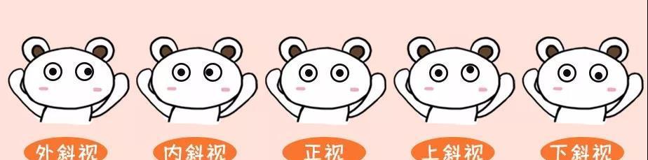 探究导致斜视的原因及预防方法（解析斜视形成的原因及有效的预防措施）