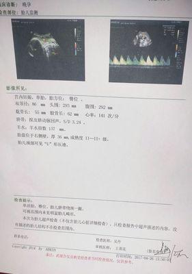 胎位不正如何纠正？有哪些有效的方法和注意事项？