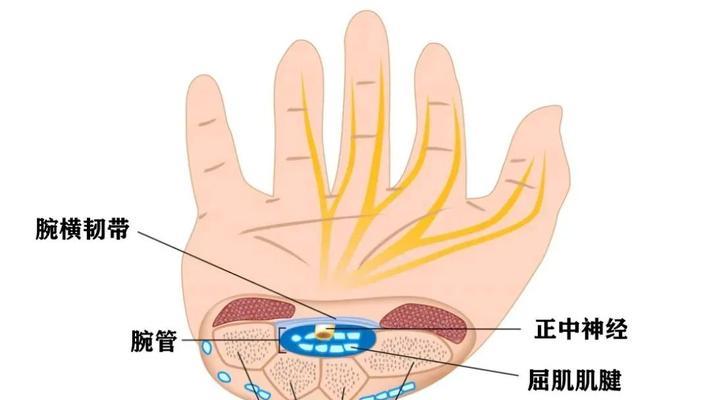 鼠标手疼痛难忍怎么办？有效缓解方法有哪些？