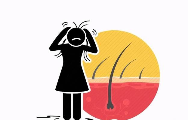 掉头发是什么原因？如何有效预防和治疗？